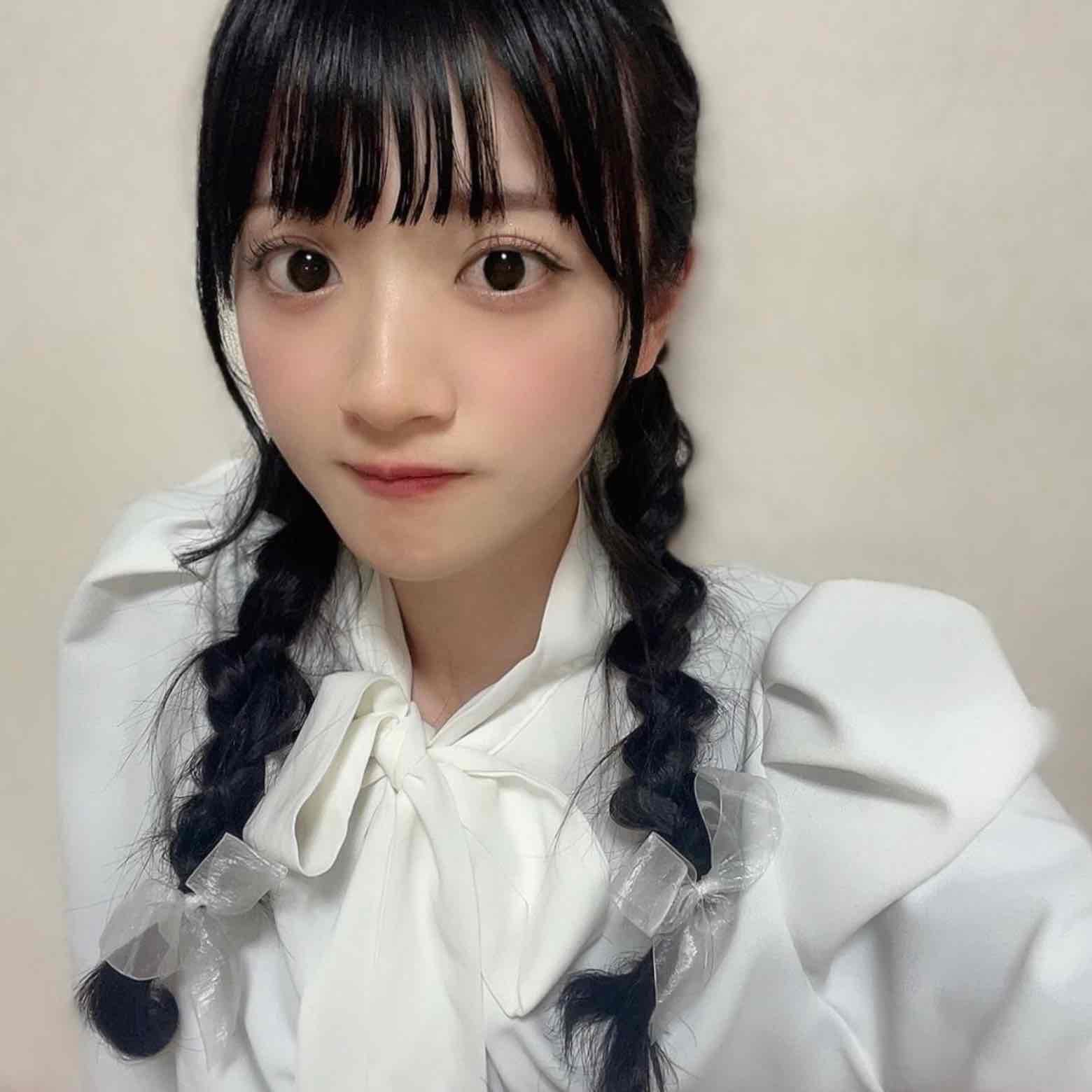 radio_img_url