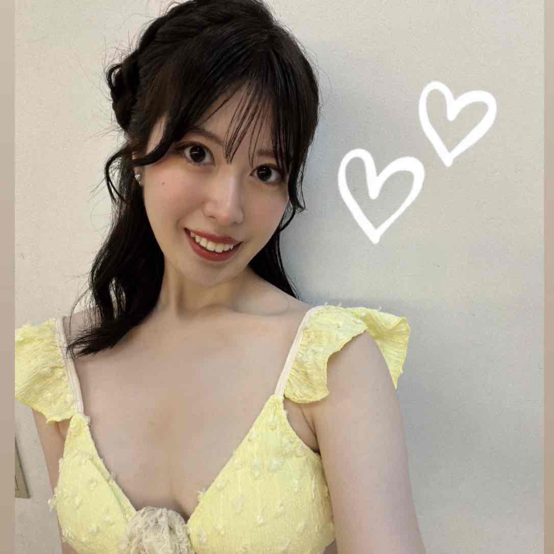 radio_img_url