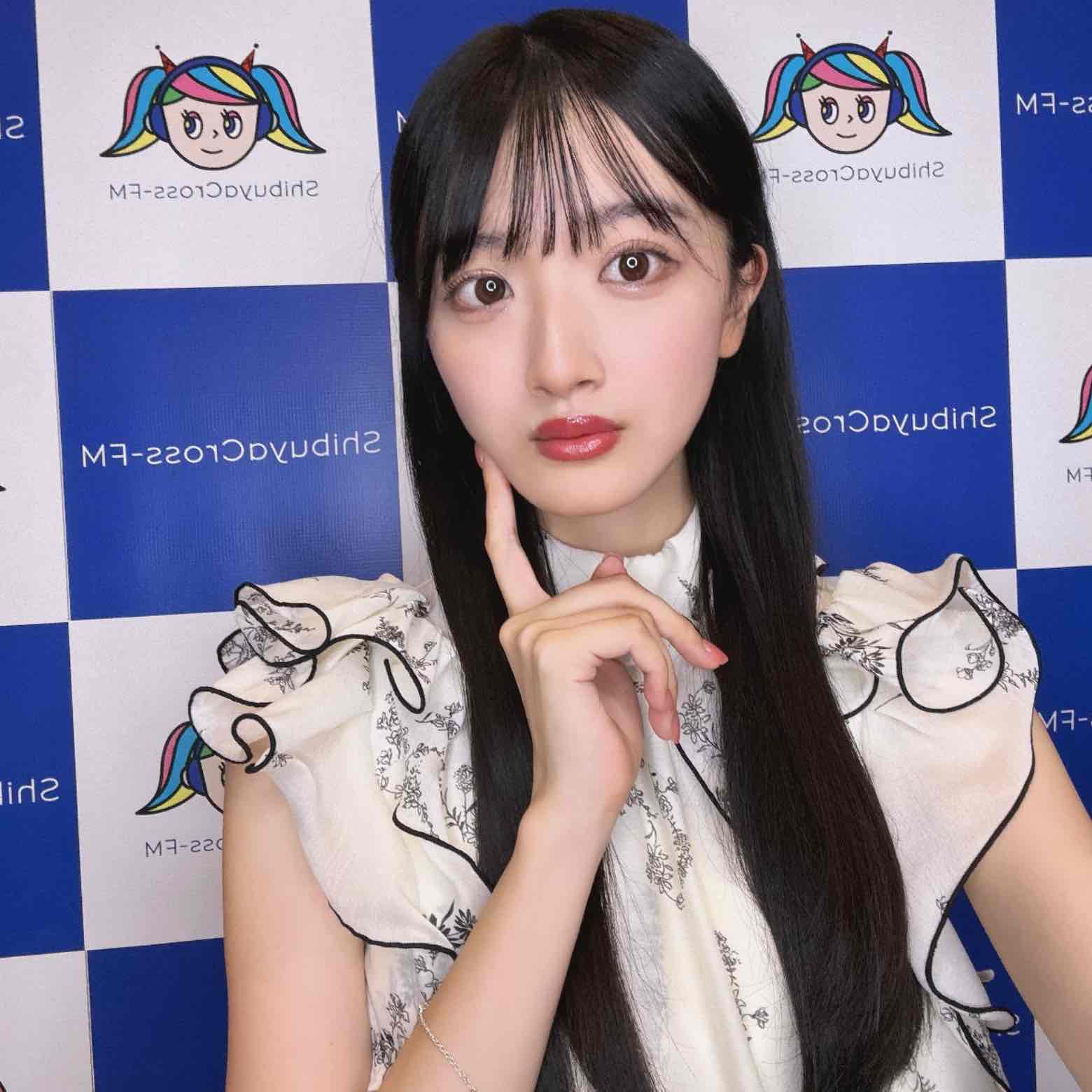 radio_img_url